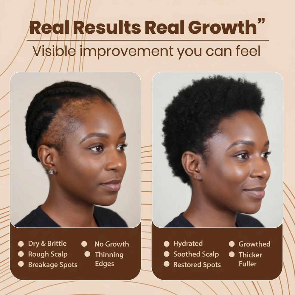 Synera™ – Hair Renewal Scrub