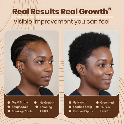 Synera™ – Hair Renewal Scrub